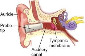 پوزیشن و قرار گرفتن ترمومتر تیمپانیک در داخل گوش به روش صحیح