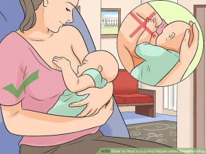 آزاد بودن سر و گردن نوزاد در هنگام تغذیه شیر مادر